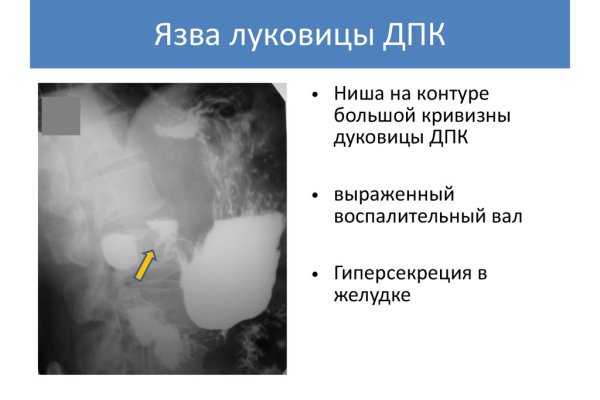 Кракен наркоз магазин